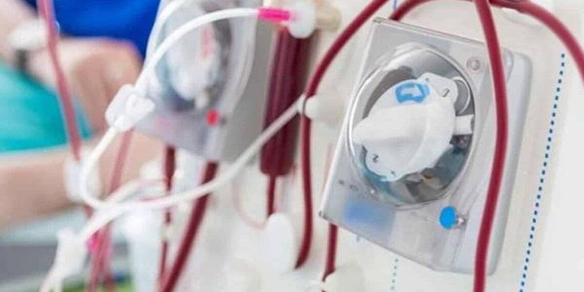 La enfermedad renal crónica es la novena causa principal de muerte en el mundo